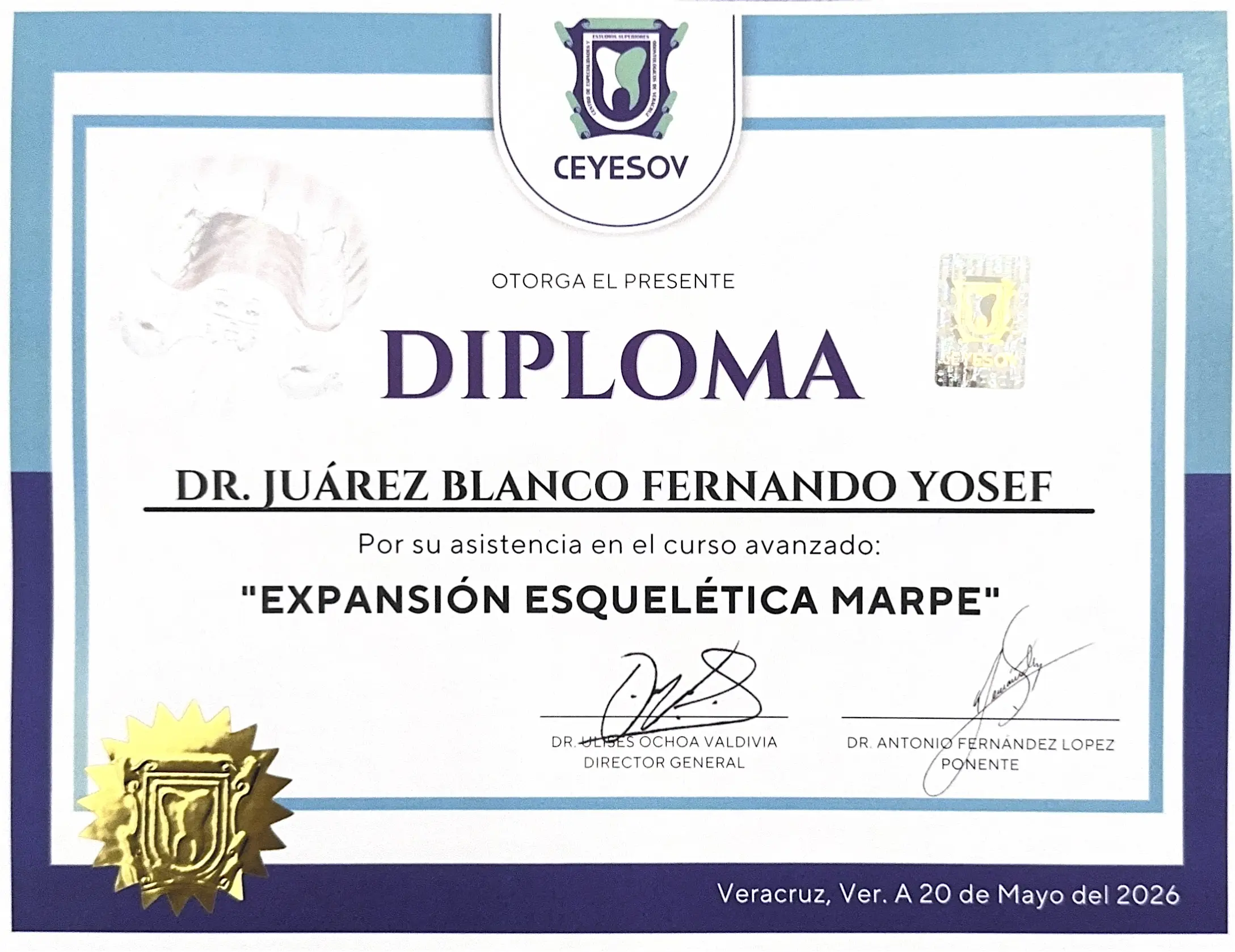 Expansión Esquelética MARPE - Dr. Antonio Fernández López