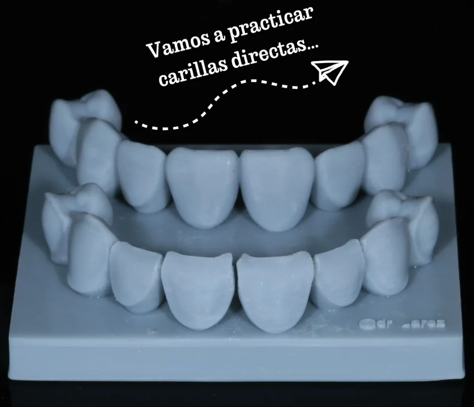 Proceso de carillas dentales en Veracruz