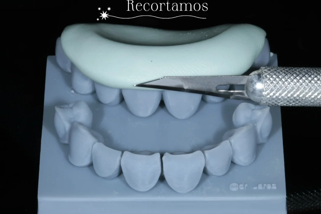 Elaboracion de guía para carillas