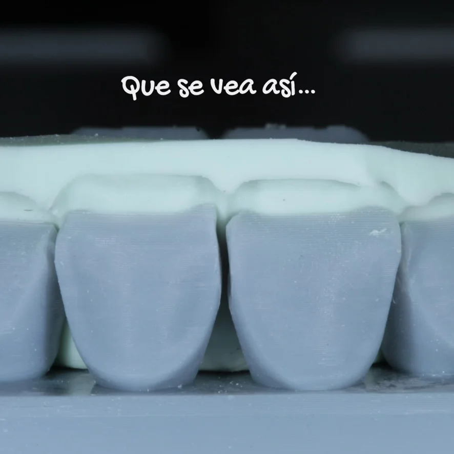 Bordes con transparencias en carillas