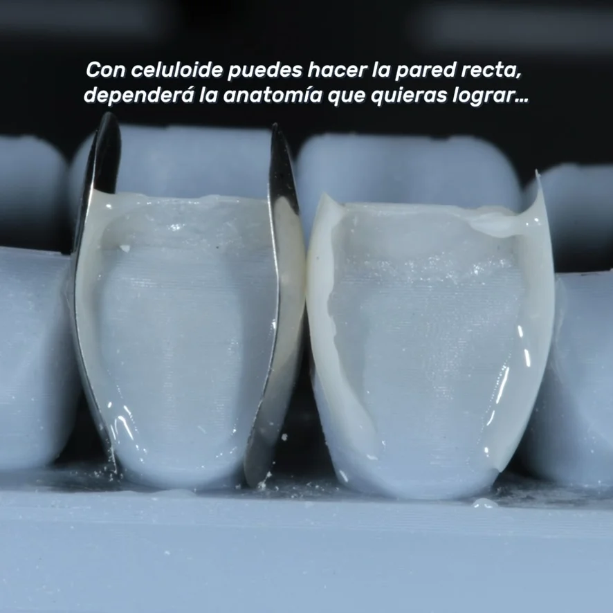 Paredes proximales