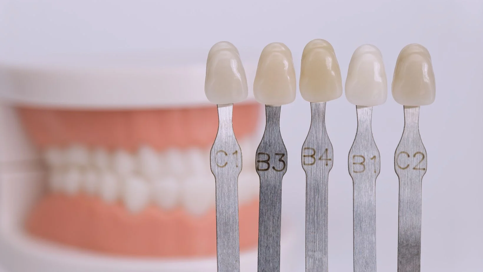 Selección de color para diseño de sonrisa y carillas en Veracruz