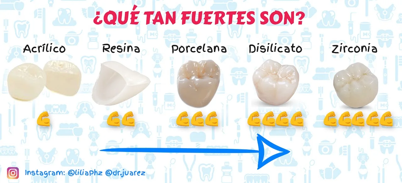 Prótesis fija en Veracruz: coronas y puentes de porcelana, disilicato o zirconia